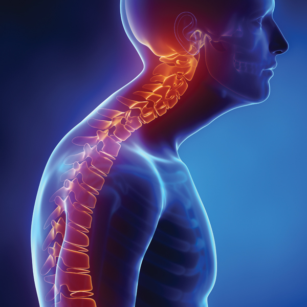 spine fracture