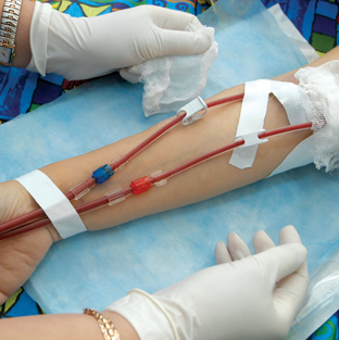 dialysis
